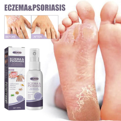 Hand And Foot Care Spray Relieves Dry Skin CuddleNest Enterprise