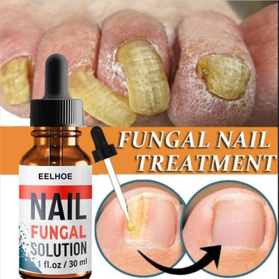 Hand and Foot Onychomycosis Care And Repair Liquid CuddleNest Enterprise